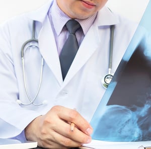 Surgeon reviewing an X-ray scan